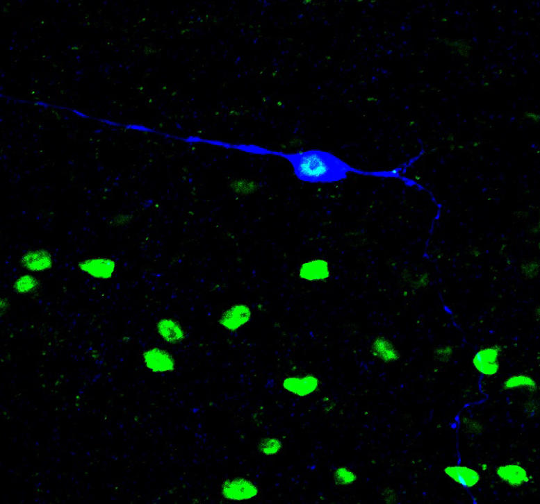 Itch Responsive Neuron