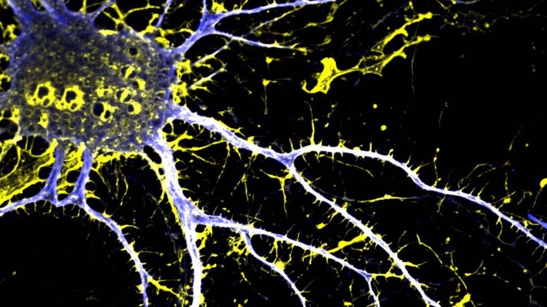 JRT Treated Cortical Neuron