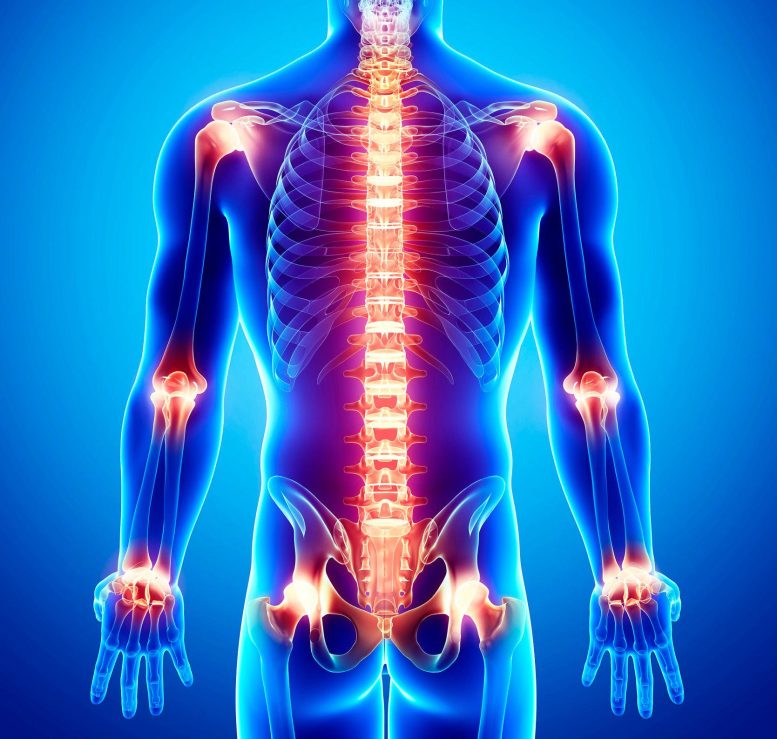 Joint Pain Spine