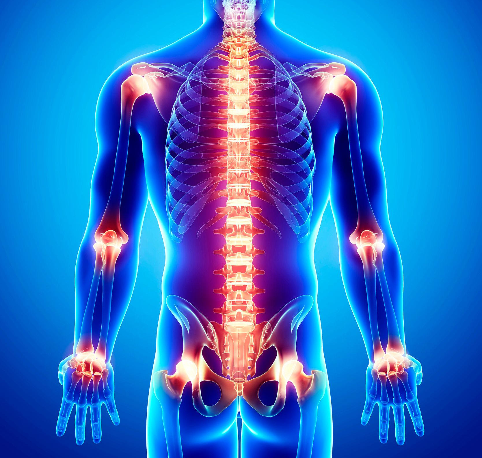 Joint Pain Spine