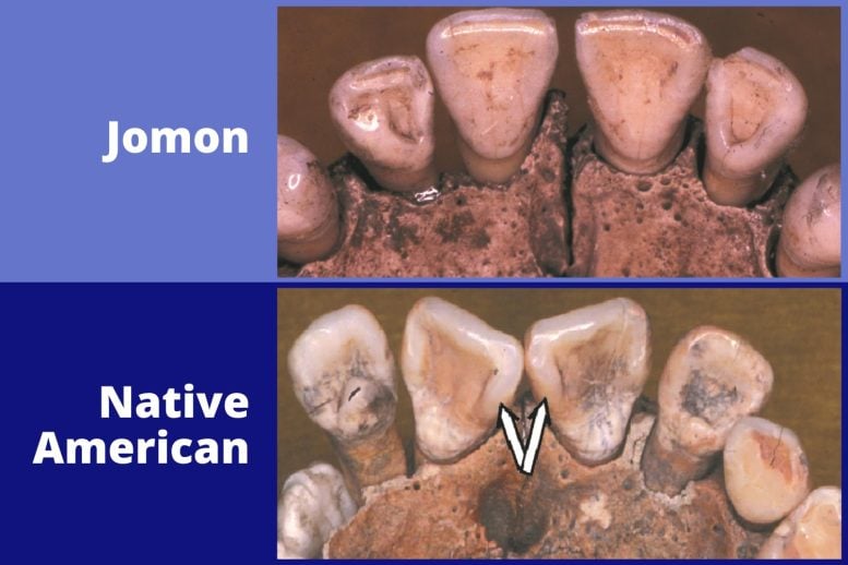 Jomon and Native American Teeth