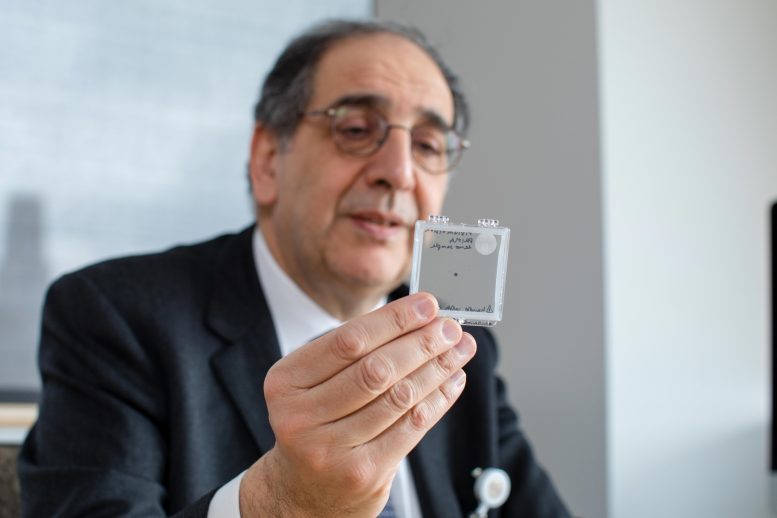 José Alain Sahel Holding the PRIMA Implant