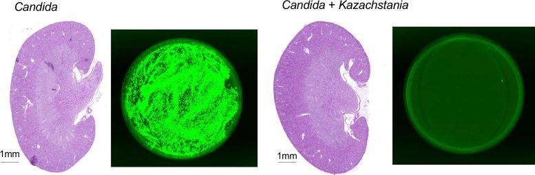 K. weizmannii Mitigates Invasive Candidiasis in Immunosuppressed Mice Graphic