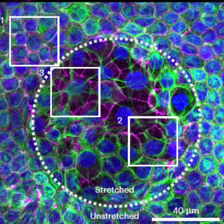 Keratin 18 Actin Nucleaus