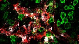 Killer-T Cells Attack Lymphatic Vessels