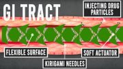 Kirigami Inspired Stent GI Tract