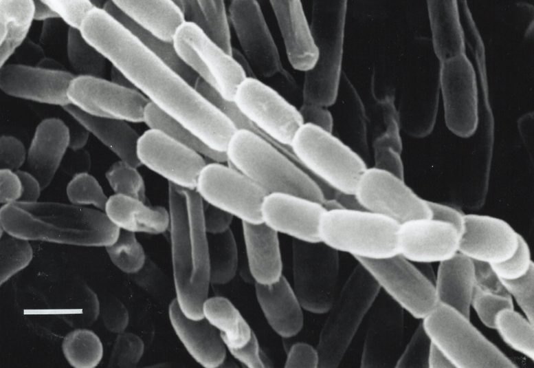 Kitasatospora Setae Bacterium Slac