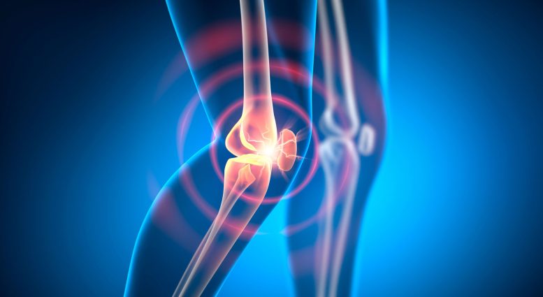 Knee Joint Pain Arthritis