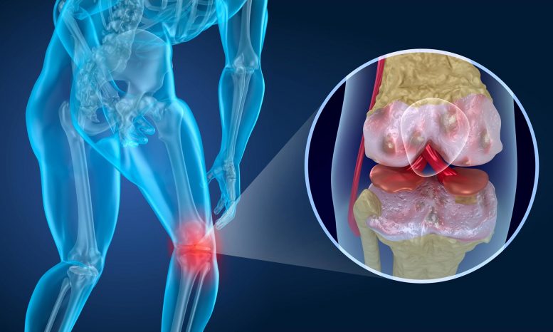 Knee Pain Concept