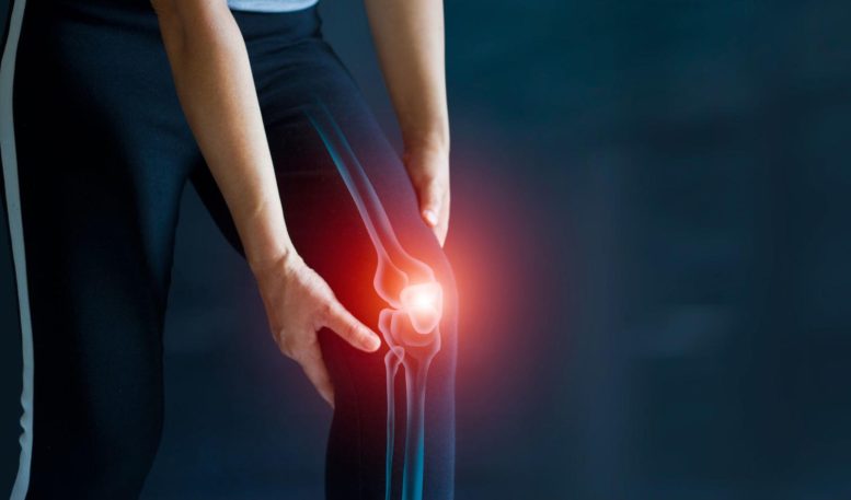 Osteoarthritis Breakthrough: New Therapeutic Approach Discovered