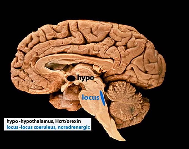 Labeled Brain Showing Hypothalamus and Locus Coeruleus