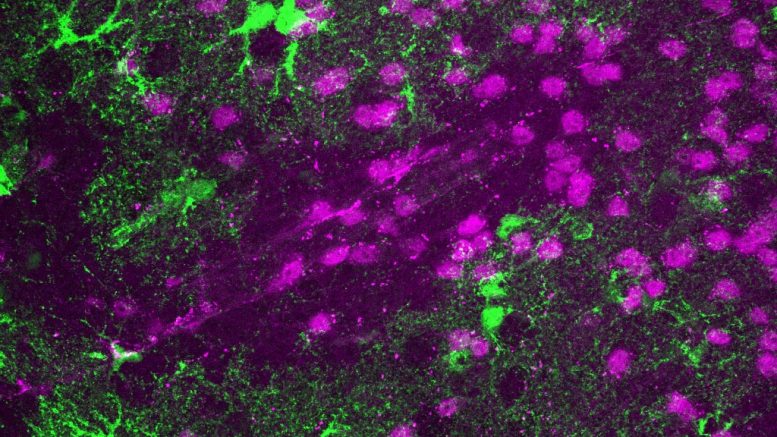 New Research Uncovers Blood-Brain Barrier Mystery