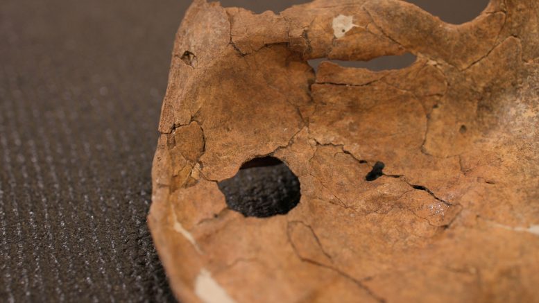 Left Scapula of Shanidar A