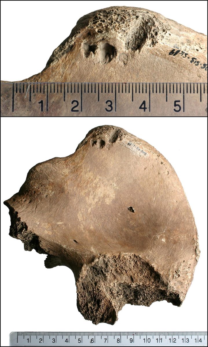 Lesion on the Right Ilium of 6DT19
