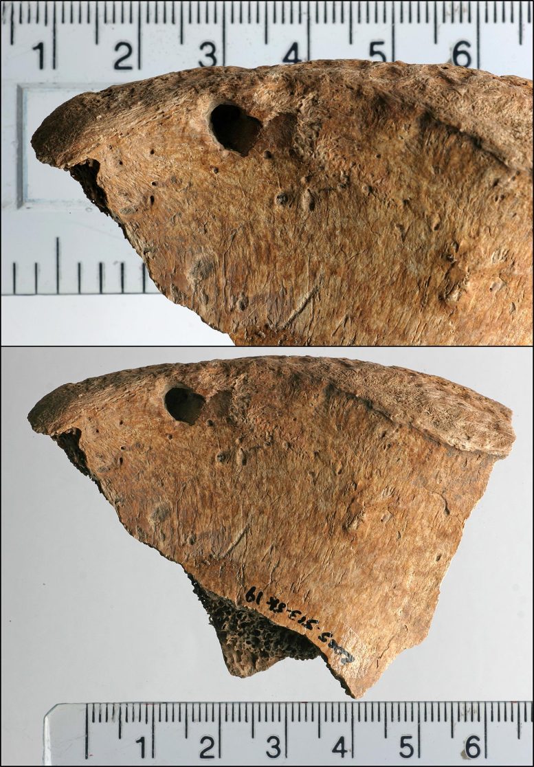 Lesions on the Left Iliac Spine of 6DT19
