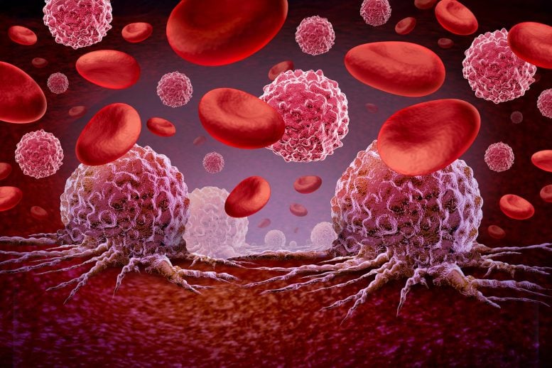 Leukemia Cancer Blood Malignant Cells