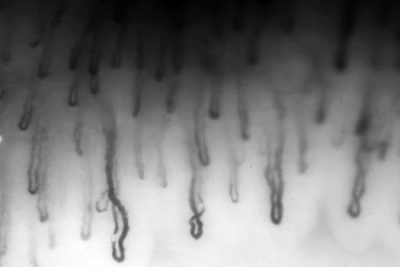 Leuko Insect No More Needles: Leuko’s Revolutionary Device Could Save Lives of ...