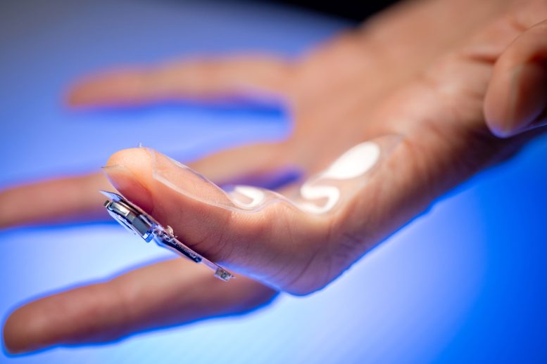Levodopa Monitor Fingertip Patch