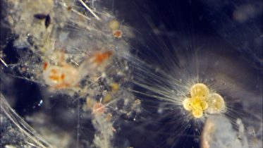 Light Microscope Image of Planktonic Foraminifera