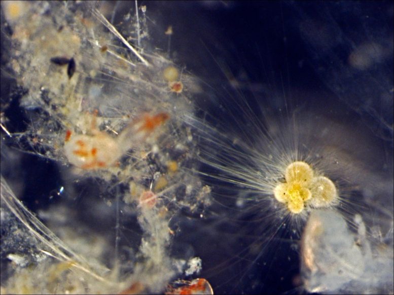 Light Microscope Image of Planktonic Foraminifera