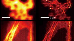 Light-Shrinking Material Super Resolution Microscope