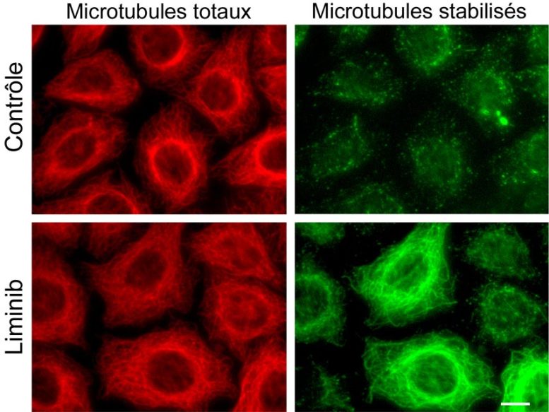 Liminib Stabilizes the Microtubules