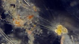 Live Foraminifera Under Light Microscope