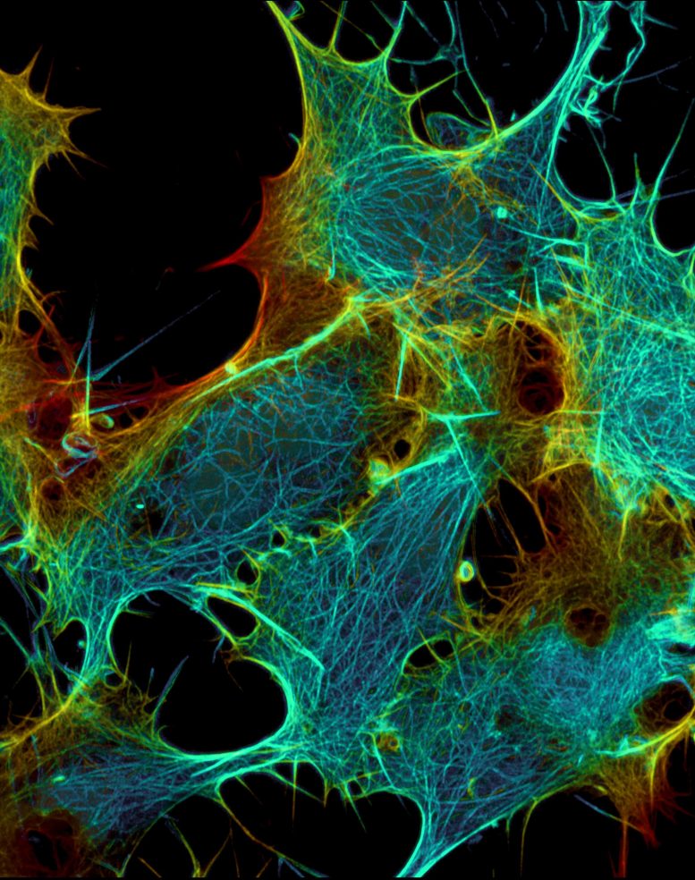 Live Imaging of Cytoskeletal Networks