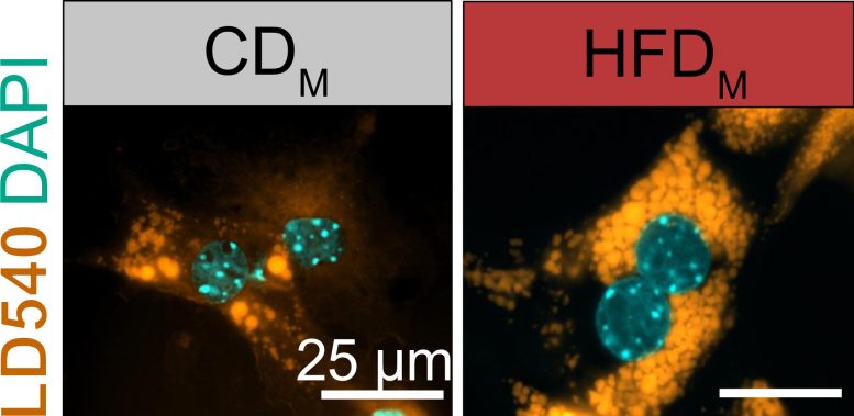 Liver Cells Exposed to Offspring of Obese Mice