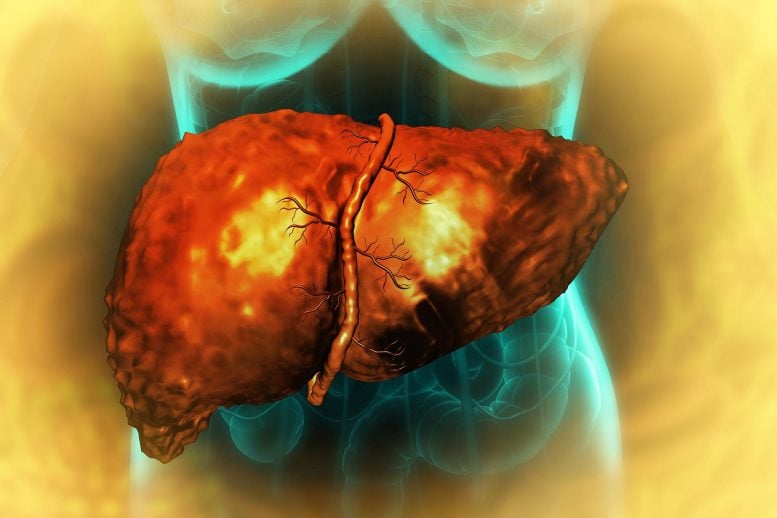 MIT Reveals How High-Fat Diets Quietly Prime the Liver for Cancer