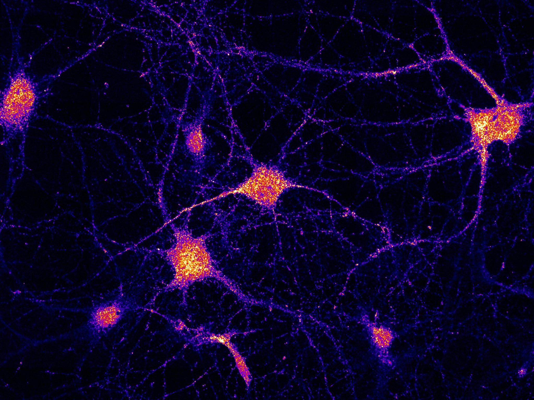El eslabón perdido explica la entrega de ARNm en las células cerebrales