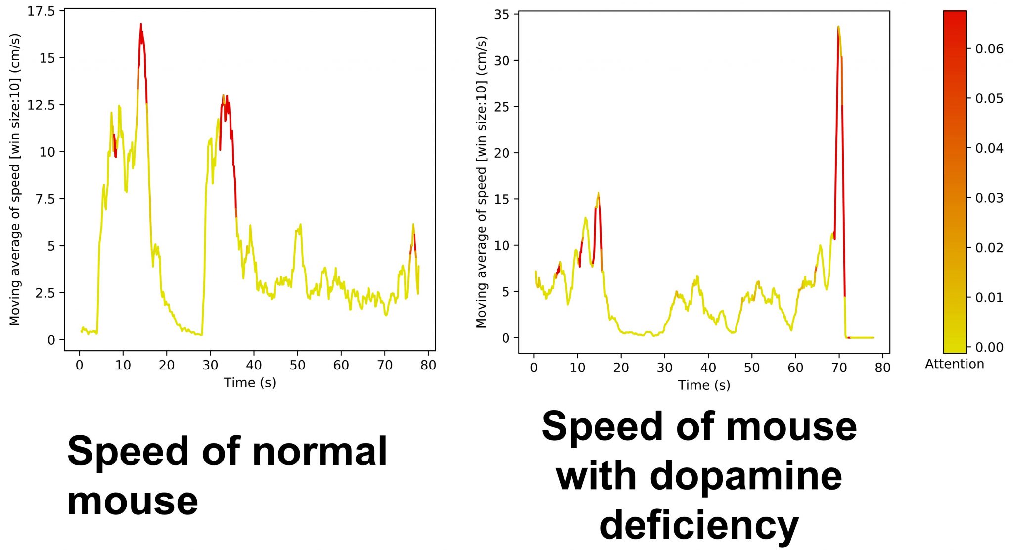 AI Reveals Walking Patterns of Movement Disorders Shared Among Worms ...
