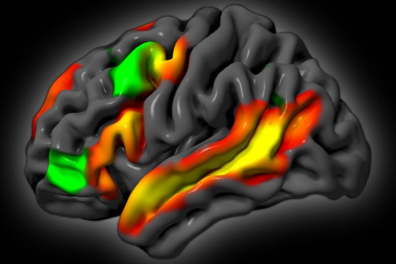 Logic and Language Brain Activations