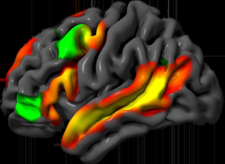 Logic and Language Brain Activations