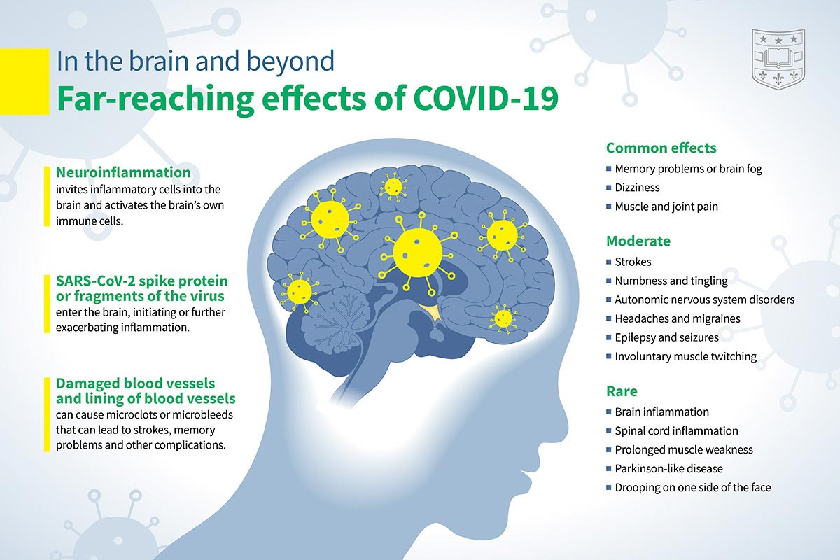 COVID 19 Infections Increase Risk Of Long Term Brain Problems Strokes 