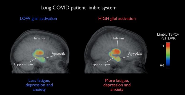 Long COVID Patient Limbic System