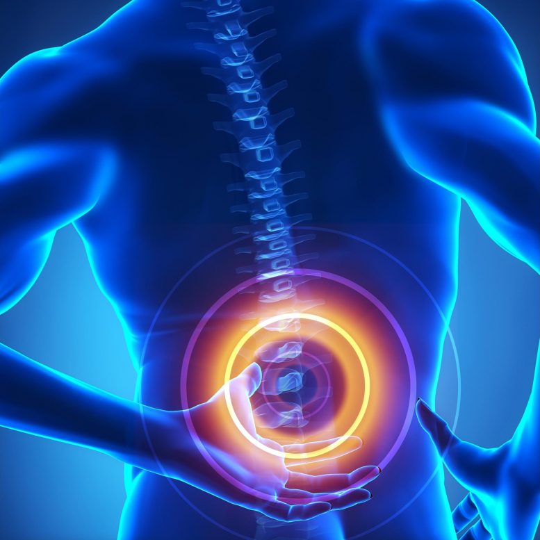 New Study Finds Muscle Relaxants Largely Ineffective for Lower Back Pain