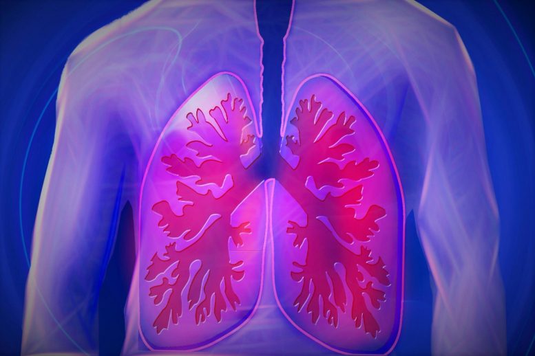 Lung Disease Illustration