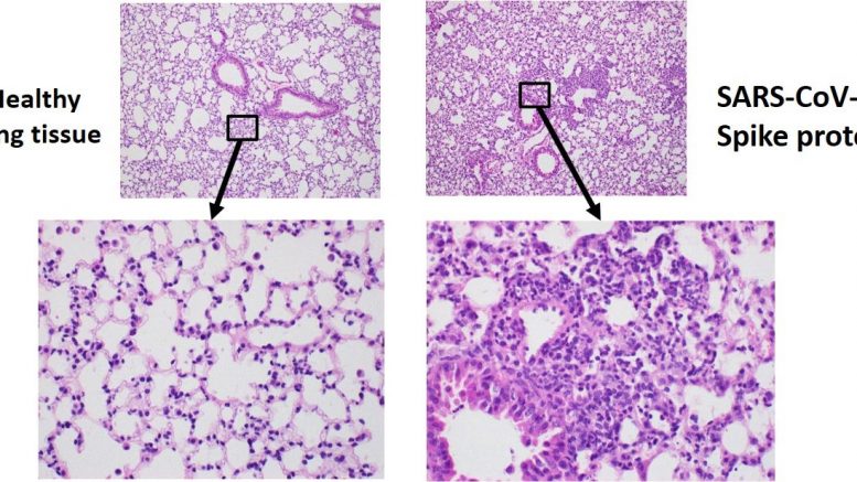 Scientists Discover Protein in the Lungs That Blocks COVID-19 Infection ...