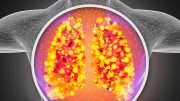 Lungs Respiratory System Infection