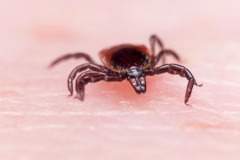 Lyme Disease Deer Tick on Skin