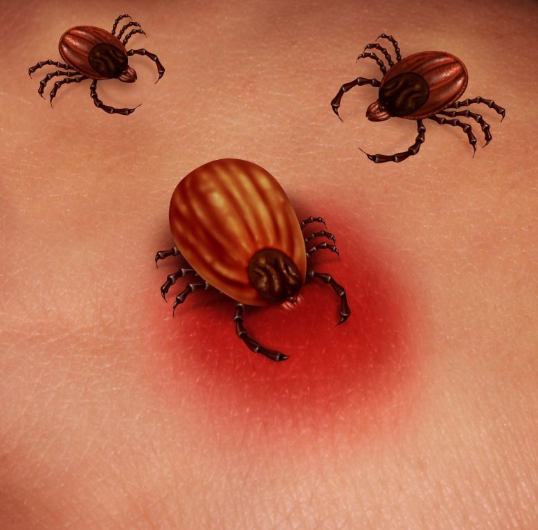 Lyme Disease Tick