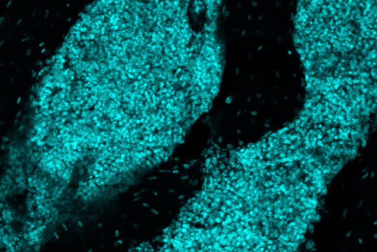 Lymph Node Like Structures in Cyan
