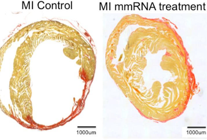 MI mmRNA Heart Treatment