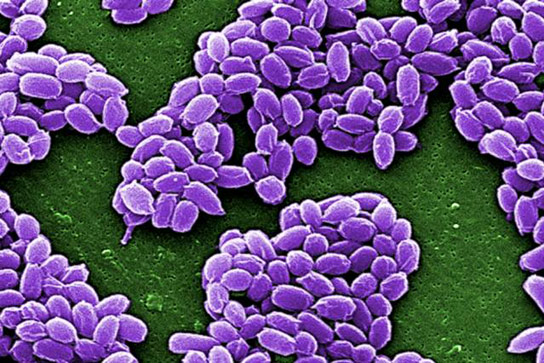 MIT Chemists Use Anthrax to Deliver Cancer Drugs