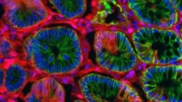 MIT Researchers Develop New Model to Speed up Colon Cancer Research