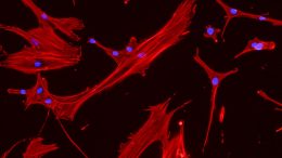 MIT Stem Cells Help Blood Cells Regenerate