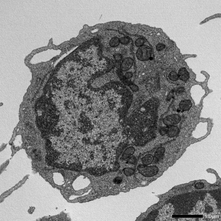 MLKL Dependent Mitochondrial Changes in Aged Hematopoietic Stem Cells