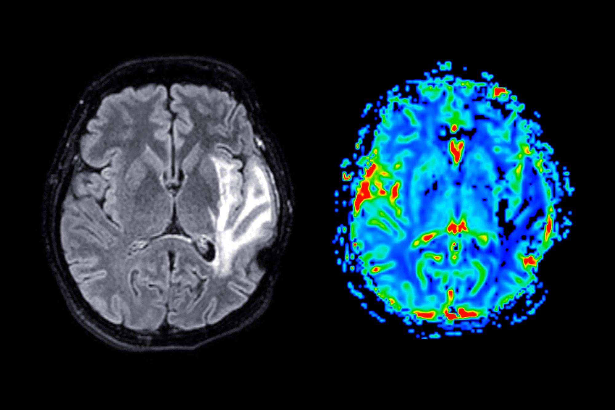 This Is What Happens in Your Brain During a Soccer Match
