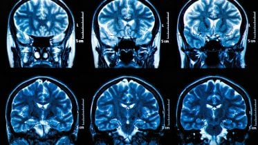 MRI Brain Scan Neuroscience Images